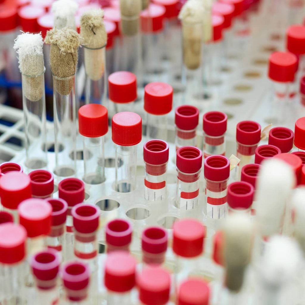 Laboratory Research Sheds Light on Epigenetic Changes Across Generations